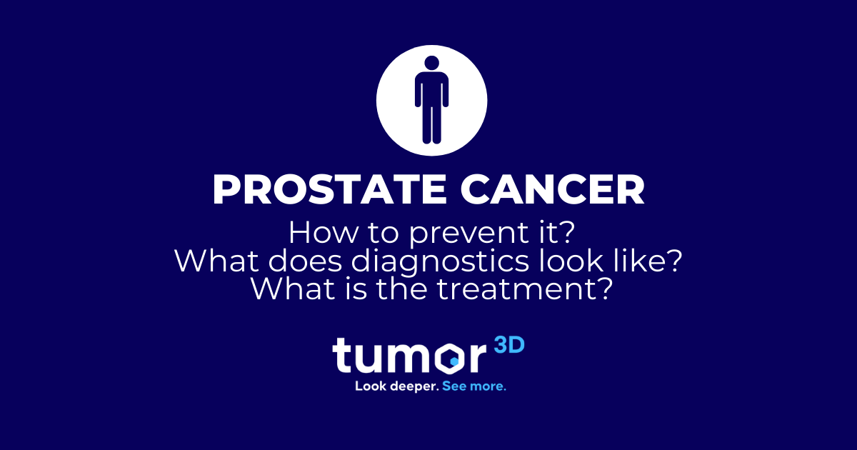 Prostate Cancer — Causes Diagnosis Treatment